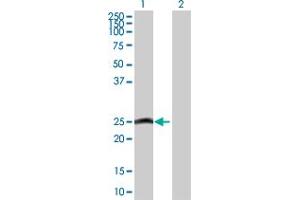 Western Blot analysis of MYL6B expression in transfected 293T cell line by MYL6B MaxPab polyclonal antibody. (MYL6B antibody  (AA 1-208))
