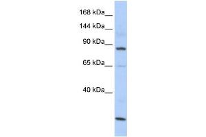Western Blotting (WB) image for anti-MutS Homolog 5 (MSH5) antibody (ABIN2458577)