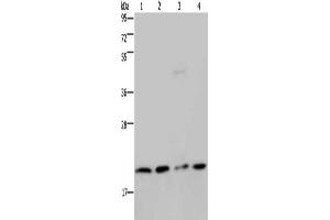 Gel: 10 % SDS-PAGE, Lysate: 40 μg, Lane 1-4: Jurkat cells, K562 cells, PC3 cells, A549 cells, Primary antibody: ABIN7130206(MCTS1 Antibody) at dilution 1/200, Secondary antibody: Goat anti rabbit IgG at 1/8000 dilution, Exposure time: 3 minutes (MCTS1 antibody)