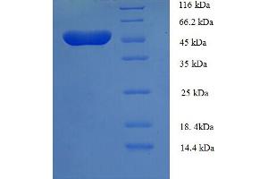 TEAD3 Protein (AA 112-435, partial) (His-SUMO Tag)