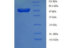 SDS-PAGE (SDS) image for TEA Domain Family Member 3 (TEAD3) (AA 112-435), (partial) protein (His-SUMO Tag) (ABIN4976573)