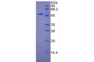 SDS-PAGE analysis of Mouse CPT1A Protein. (CPT1A Protein)