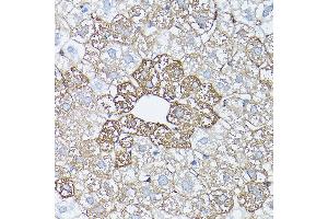 Immunohistochemistry of paraffin-embedded rat liver using [KO Validated] Glutamine Synthetase (Glutamine Synthetase (GLUL)) Rabbit pAb (ABIN6130425, ABIN6141161, ABIN6141162 and ABIN7101772) at dilution of 1:150 (40x lens).