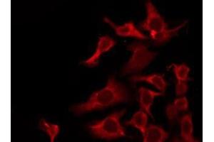 OR6J1 antibody