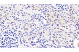 Detection of LAMa3 in Human Kidney Tissue using Polyclonal Antibody to Laminin Alpha 3 (LAMa3) (LAMA3 antibody  (AA 47-296))