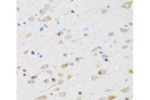 Immunohistochemistry of paraffin-embedded Rat brain using CHRM5 Polyclonal Antibody at dilution of 1:100 (40x lens).
