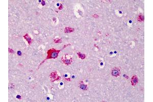 Anti-SLC35D1 antibody IHC of human brain, cortex. (SLC35D1 antibody  (N-Term))