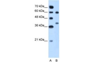 Western Blotting (WB) image for anti-Arginase, Liver (ARG1) antibody (ABIN2462876) (Liver Arginase antibody)