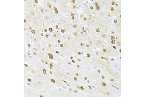 Immunohistochemistry (Paraffin-embedded Sections) (IHC (p)) image for anti-Acidic (Leucine-Rich) Nuclear phosphoprotein 32 Family, Member A (ANP32A) (AA 1-170) antibody (ABIN6136909)