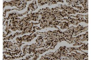 ABIN6273321 at 1/100 staining Human lung tissue by IHC-P. (SMYD3 antibody  (N-Term))