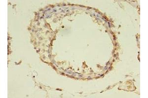 Immunohistochemistry of paraffin-embedded human testis tissue using ABIN7173651 at dilution of 1:100 (TUBA1A antibody  (AA 30-229))