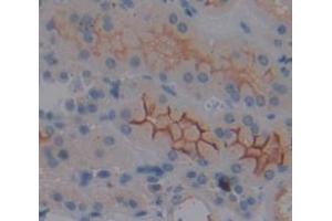 Used in DAB staining on fromalin fixed paraffin- embedded Kidney tissue (MT-ND1 antibody  (AA 19-84))