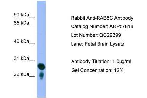 WB Suggested Anti-RAB5C  Antibody Titration: 0.