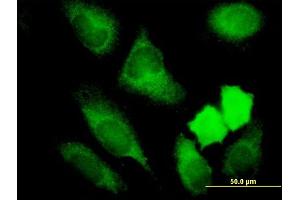 Immunofluorescence of monoclonal antibody to NRBP1 on HeLa cell. (NRBP1 antibody  (AA 436-535))