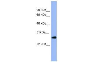 WB Suggested Anti-RAB5A Antibody Titration: 0. (RAB5 antibody  (Middle Region))