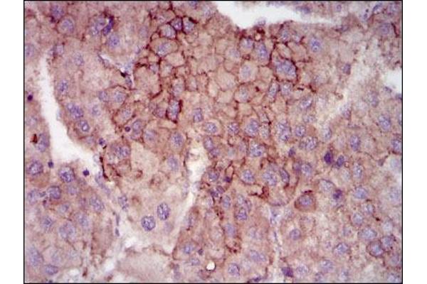 MELK antibody  (AA 637-651)