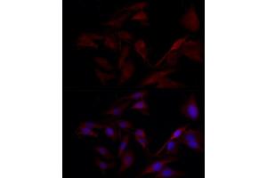 Immunofluorescence analysis of U2OS cells using TYK2 Rabbit pAb (ABIN3022987, ABIN3022988, ABIN3022989 and ABIN6219333) at dilution of 1:150 (40x lens). (TYK2 antibody  (AA 750-850))