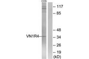 Western blot analysis of extracts from COS7 cells, using VN1R4 Antibody. (VN1R4 antibody  (AA 88-137))