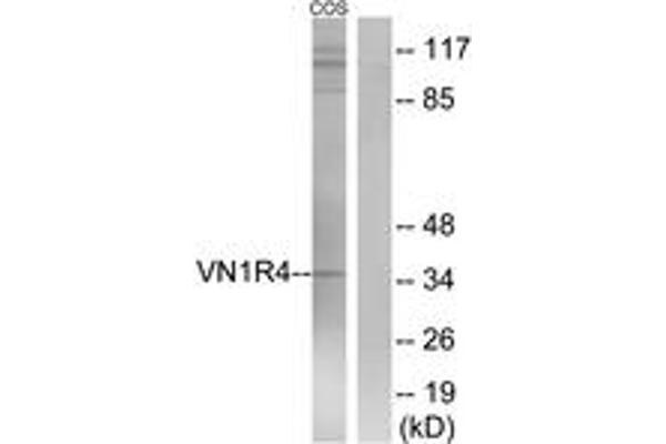VN1R4 抗体  (AA 88-137)