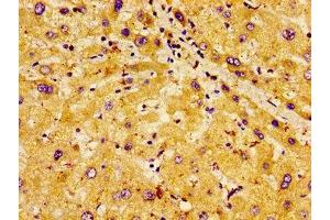 Immunohistochemistry of paraffin-embedded human liver tissue using ABIN7163666 at dilution of 1: 100 (PHLDA1 antibody  (AA 1-138))