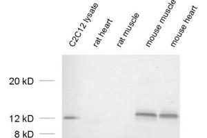 dilution: 1 : 1000 (VAMP5 antibody  (AA 1-70))