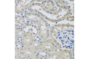 Immunohistochemistry of paraffin-embedded mouse kidney using CHMP1B antibody at dilution of 1:100 (x40 lens).