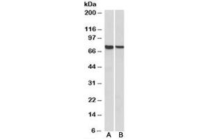 Western blot testing of mouse [A] and rat [B] spleen lysates with MUNC18-3 antibody at 1ug/ml. (STXBP3 antibody)