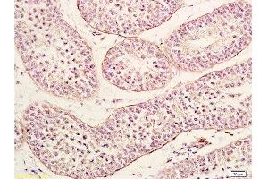 Immunohistochemistry (Paraffin-embedded Sections) (IHC (p)) image for anti-Neurturin (NRTN) (AA 151-197) antibody (ABIN724505)