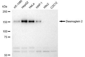 Western blotting analysis using Desmoglein 2 antibody (ABIN7798317).