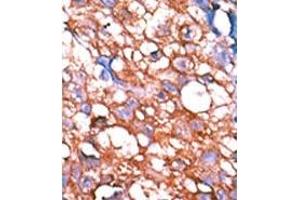 Image no. 2 for anti-V-Erb-A erythroblastic Leukemia Viral Oncogene Homolog 4 (Avian) (ERBB4) (pTyr1162) antibody (ABIN358139) (ERBB4 antibody  (pTyr1162))