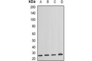 Western blot analysis of NAT8 expression in HEK293T (A), mouse spleen (B), mouse lung (C), rat kidney (D) whole cell lysates. (NAT8 antibody)