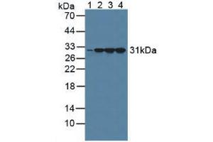 Figure. (Calretinin antibody  (AA 28-248))