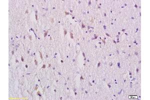 Formalin-fixed and paraffin embedded rat brain tissue labeled with Rabbit Anti-GABRA1 Polyclonal Antibody, Unconjugated (ABIN703796) at 1:200 followed by conjugation to the secondary antibody and DAB staining