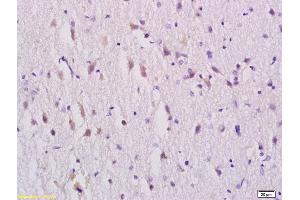 Formalin-fixed and paraffin embedded rat brain tissue labeled with Rabbit Anti-GABRA1 Polyclonal Antibody, Unconjugated (ABIN703796) at 1:200 followed by conjugation to the secondary antibody and DAB staining (GABRA1 antibody  (AA 351-456))