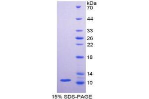 SDS-PAGE analysis of Human PKM2 Protein.