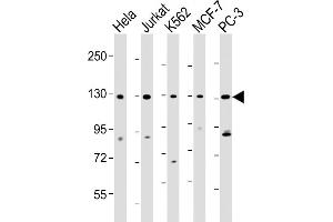All lanes : Anti-RFX1 Antibody (C-term) at 1:2000 dilution Lane 1: Hela whole cell lysate Lane 2: Jurkat whole cell lysate Lane 3: K562 whole cell lysate Lane 4: MCF-7 whole cell lysate Lane 5: PC-3 whole cell lysate Lysates/proteins at 20 μg per lane. (RFX1 antibody  (C-Term))