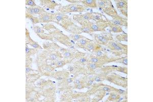 Immunohistochemistry of paraffin-embedded human liver using NUDT15 antibody at dilution of 1:100 (40x lens). (NUDT15 antibody)