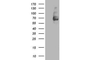 HEK293T cells were transfected with the pCMV6-ENTRY control (Left lane) or pCMV6-ENTRY LGALS3BP (Right lane) cDNA for 48 hrs and lysed. (LGALS3BP antibody  (AA 19-300))