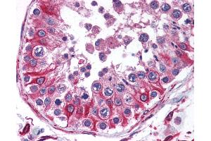 Anti-PTRH2 antibody IHC of human testis.