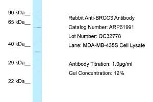 Western Blotting (WB) image for anti-BRCA1/BRCA2-Containing Complex, Subunit 3 (BRCC3) (C-Term) antibody (ABIN2788977) (BRCC3 antibody  (C-Term))