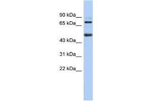 WB Suggested Anti-ZBTB26 Antibody Titration:  0. (ZBTB26 antibody  (N-Term))
