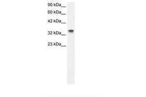 Image no. 2 for anti-Nucleophosmin (Nucleolar phosphoprotein B23, Numatrin) (NPM1) (N-Term) antibody (ABIN202181) (NPM1 antibody  (N-Term))