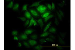 Immunofluorescence of monoclonal antibody to KNTC1 on HeLa cell. (KNTC1 antibody  (AA 2100-2209))