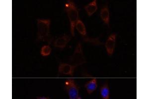 Immunofluorescence analysis of NIH/3T3 cells using YTHDC2 Polyclonal Antibody at dilution of 1:100. (YTHDC2 antibody)