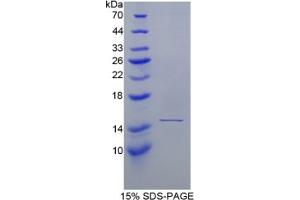 SDS-PAGE of Protein Standard from the Kit (Highly purified E. (Haptoglobin ELISA Kit)