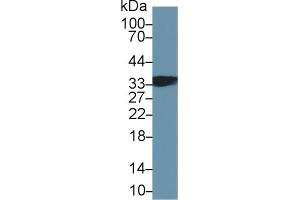 Detection of TNNT1 in Mouse Skeletal muscle lysate using Polyclonal Antibody to Troponin T Type 1, Slow Skeletal (TNNT1) (TNNT1 antibody  (AA 1-259))