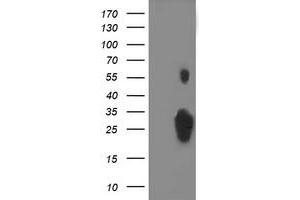 Western Blotting (WB) image for anti-Chromosome 1 Open Reading Frame 50 (C1ORF50) antibody (ABIN1497034) (C1ORF50 antibody)