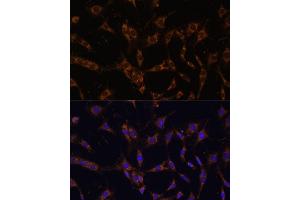 Immunofluorescence analysis of C6 cells using UBE2J1 antibody (ABIN7271172) at dilution of 1:100. (UBE2J1 antibody  (AA 1-100))