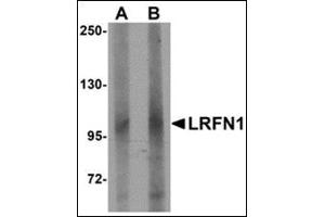 Western blot analysis of LRFN1 in human brain lysate with this product at (A) 1 and (B) 2 μg/ml.