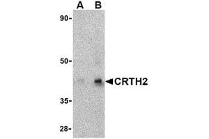 Western blot analysis of CRTH2 in human heart tissue lysate with CRTH2 antibody at (A) 1 and (B) 2 μg/ml. (Prostaglandin D2 Receptor 2 (PTGDR2) (Center) antibody)